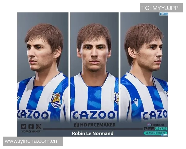 勒诺尔芒韧带无损伤恢复期预计为一个半至两个月 勒诺尔芒韧带无损伤恢复期预计为一个半至两个月